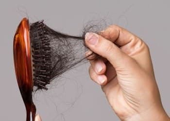 16 eflúvio telógeno